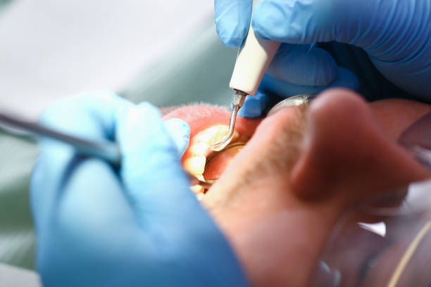 Best Knocked-Out Tooth Emergency  in Nashville, IN